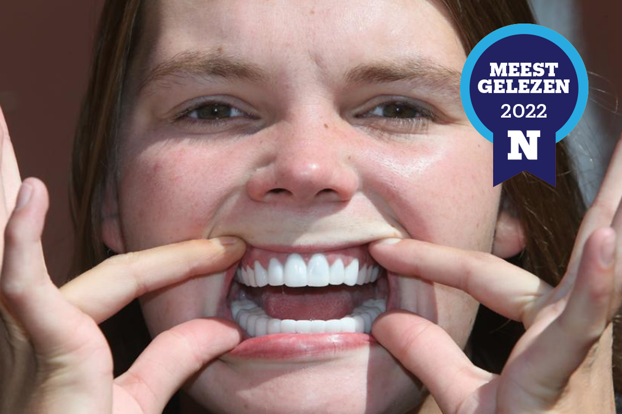 Ingang Vakman Afstudeeralbum Alana (23) reisde naar Turkije voor een nieuw gebit: “Ik kreeg mooie  tanden, maar toen begon mijn nachtmerrie” (Gavere) | Het Nieuwsblad Mobile
