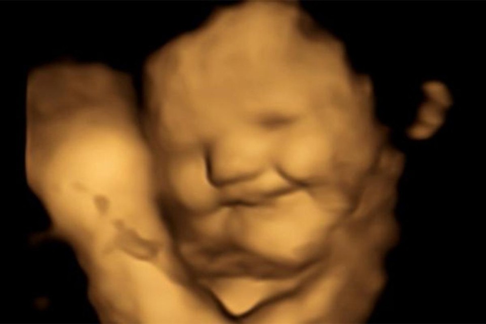 4D-echografie van foetus met een gelukkige gelaatsuitdrukking. 