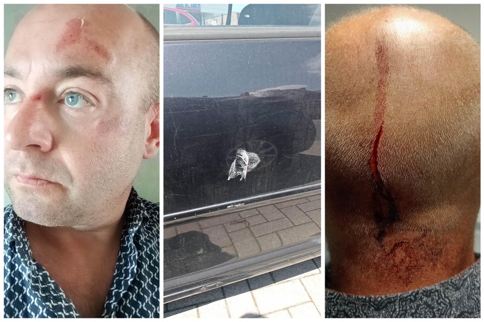 Dimitri moest negen hechtingen krijgen nadat een man hem met een brandblusapparaat aanviel. Hij herinnert zich een witte jeep. De witte verfresten op zijn wagen zijn duidelijk te zien.