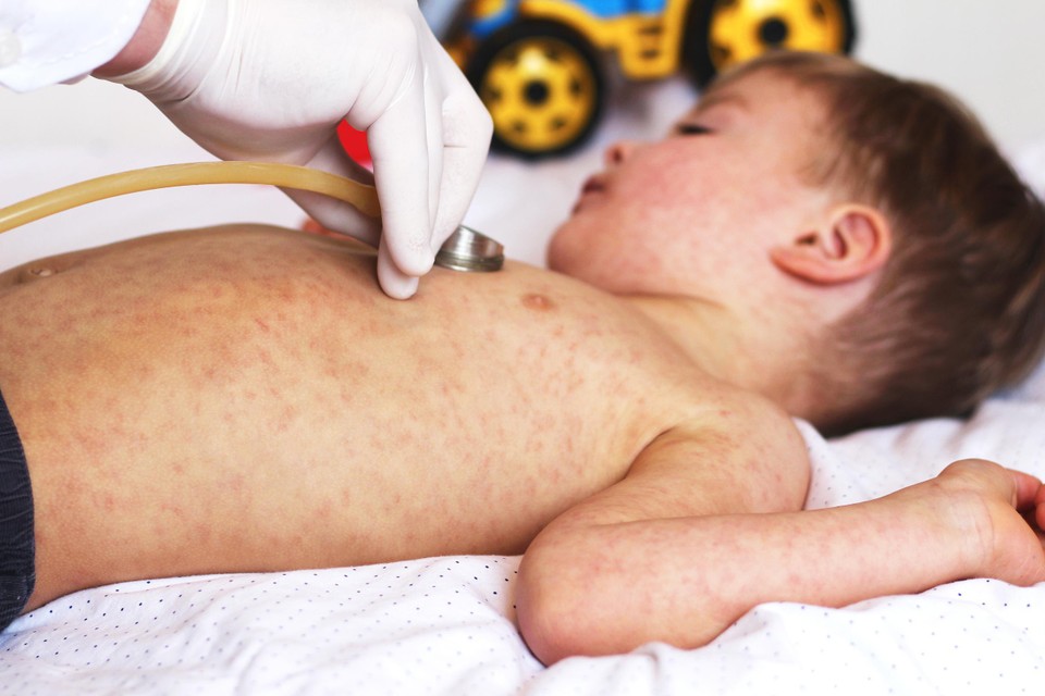Onder meer tegen mazelen zit er een vaccin in het vaccinatieschema.
