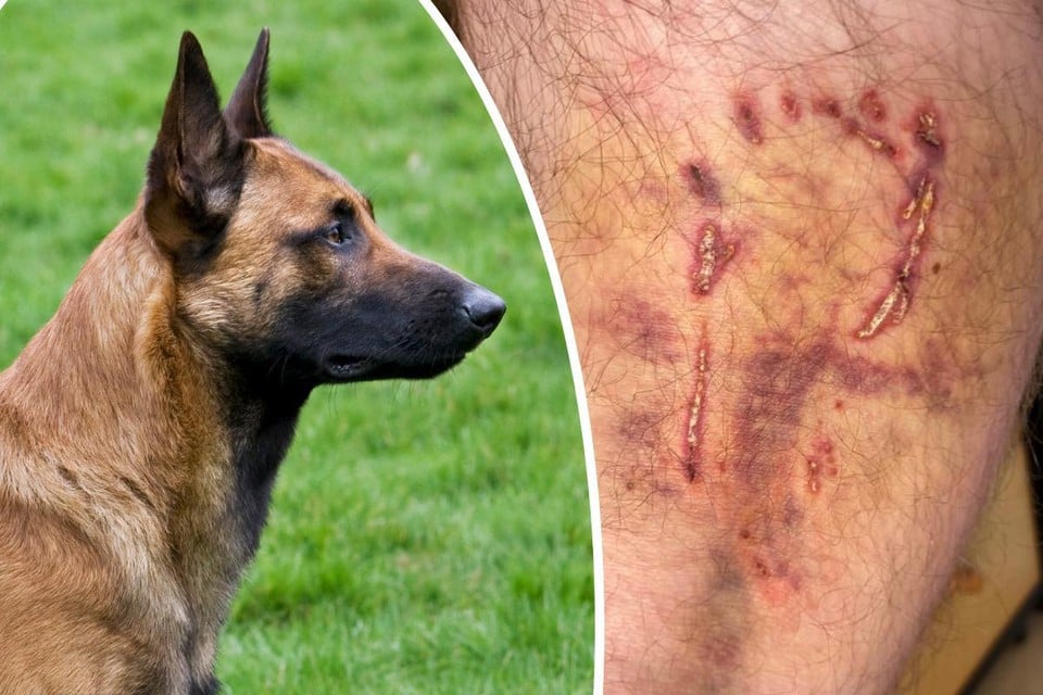Hannes (37) was attacked by two stray dogs during a walk: « I couldn’t go anywhere » (Ghent)