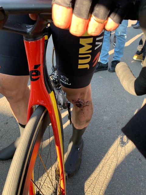 The battered knee of Van Aert. 