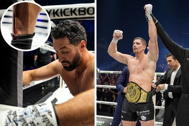 VIDEO. Jamal Ben Saddik loopt lelijke wonde op en moet kamp op Glory 100 al na een minuut staken, Rico Verhoeven behoudt wereldtitel | Het Nieuwsblad Mobile