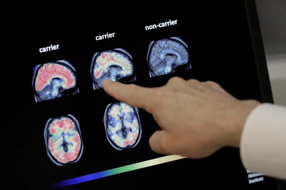 Leuven Biotech company test new and improved Alzheimermedicijn