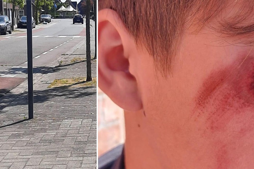 Het incident gebeurde in de Ettelgemsestraat. Liam liep onder andere verwondingen op in zijn gezicht.