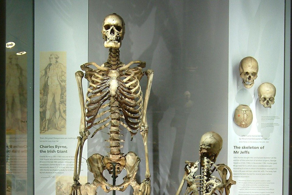 taart visie fluweel Londens museum verwijdert skelet van 'Ierse reus' wegens 'ongepast', maar  zijn laatste wens wordt nog steeds niet ingewilligd | Het Nieuwsblad Mobile
