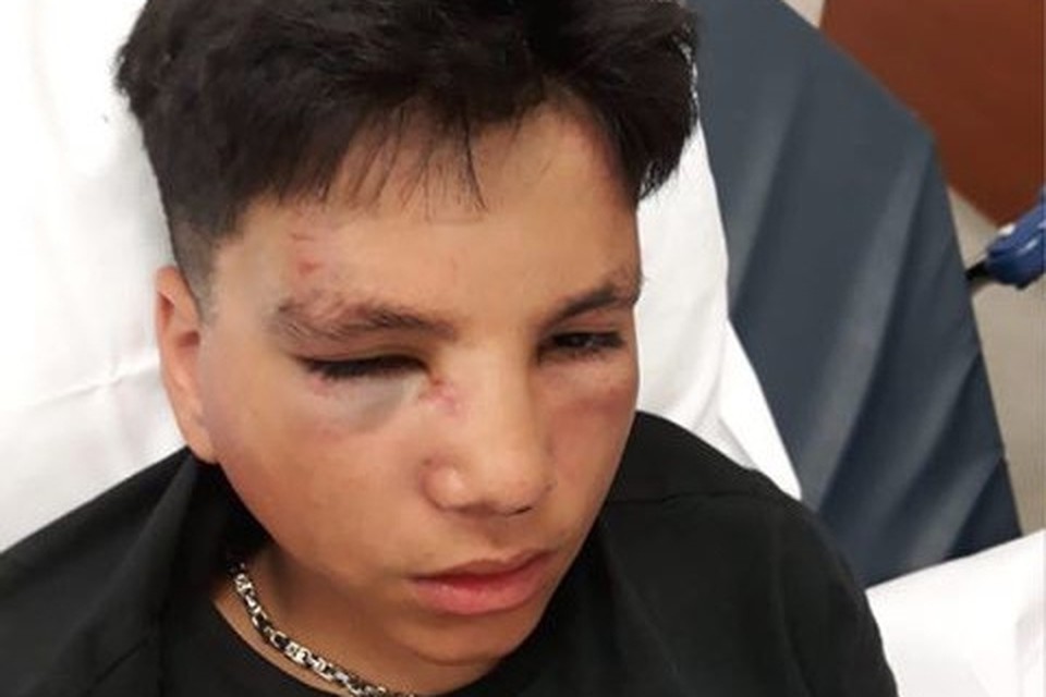 Wiskunde Oogverblindend Giftig 14-jarige in elkaar geslagen in Kotem, “enkel voor zijn Gucci pet”  (Maasmechelen) | Het Nieuwsblad Mobile