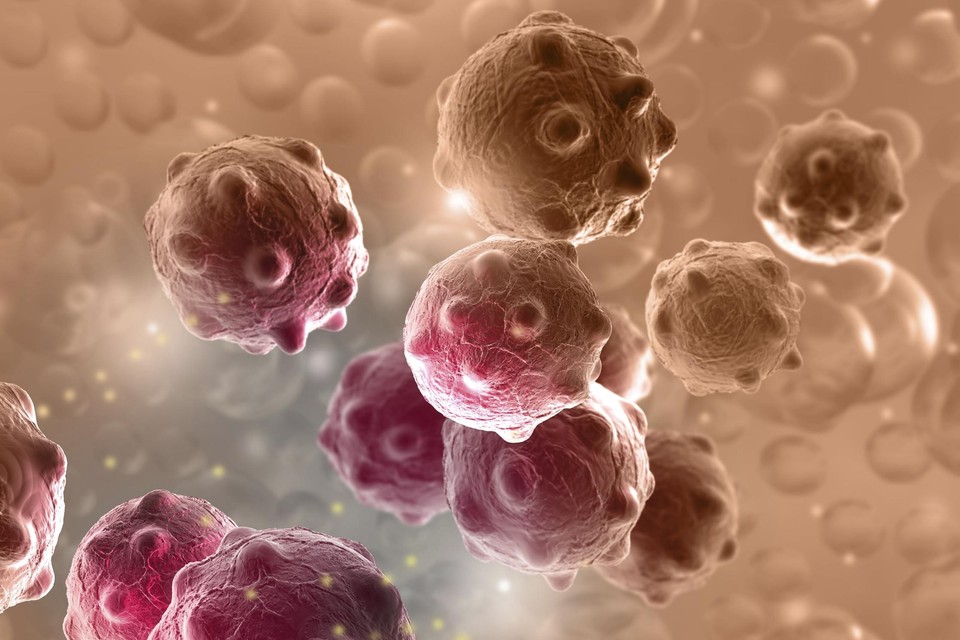 Een illustratie van kankercellen 